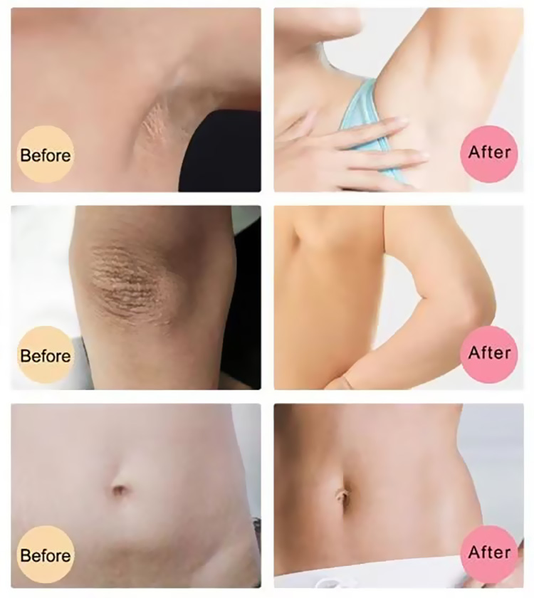 China Supplier Improve Fine Lines Collagen Mask for Supplement Collagen