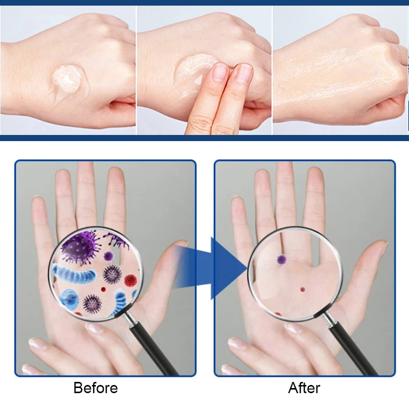50ml OEM Custom Liquid Hand Sanitiser Gel Antibacterial Rinse-Free 75% Alcohol Gel Pouch Hand Sanitizer