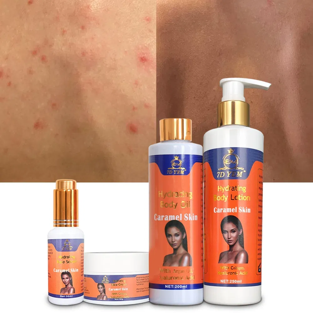 OEM Whitening Anti Acne Smooth Skin Care Sets Carotene Hydrating Brightening Skin Set for Caramel Skin