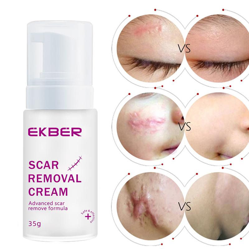 Ekber Skincare Scars Spot Removing Repair Skin Whitening Anti Freckle Cream