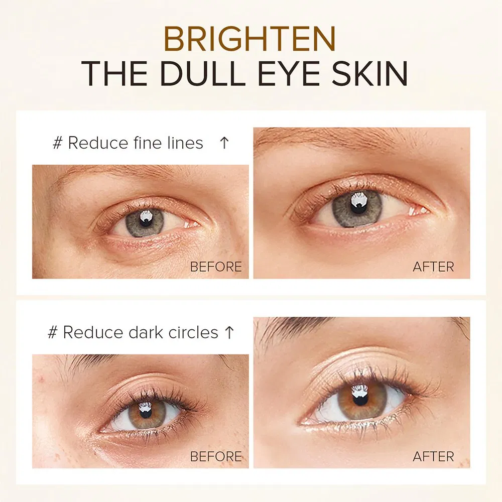 Organic Anti-Aging Wrinkle Dark Circles Under Remover Whitening 24K Gold Eye Serum
