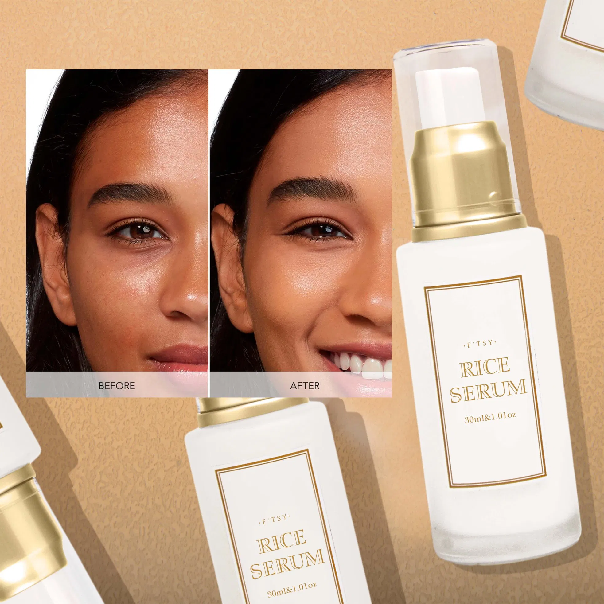 Private Label Rice Serum Customized Logo Whitening Vitamin B Nourish Blemishes Healthy Glow Rice Face Serum