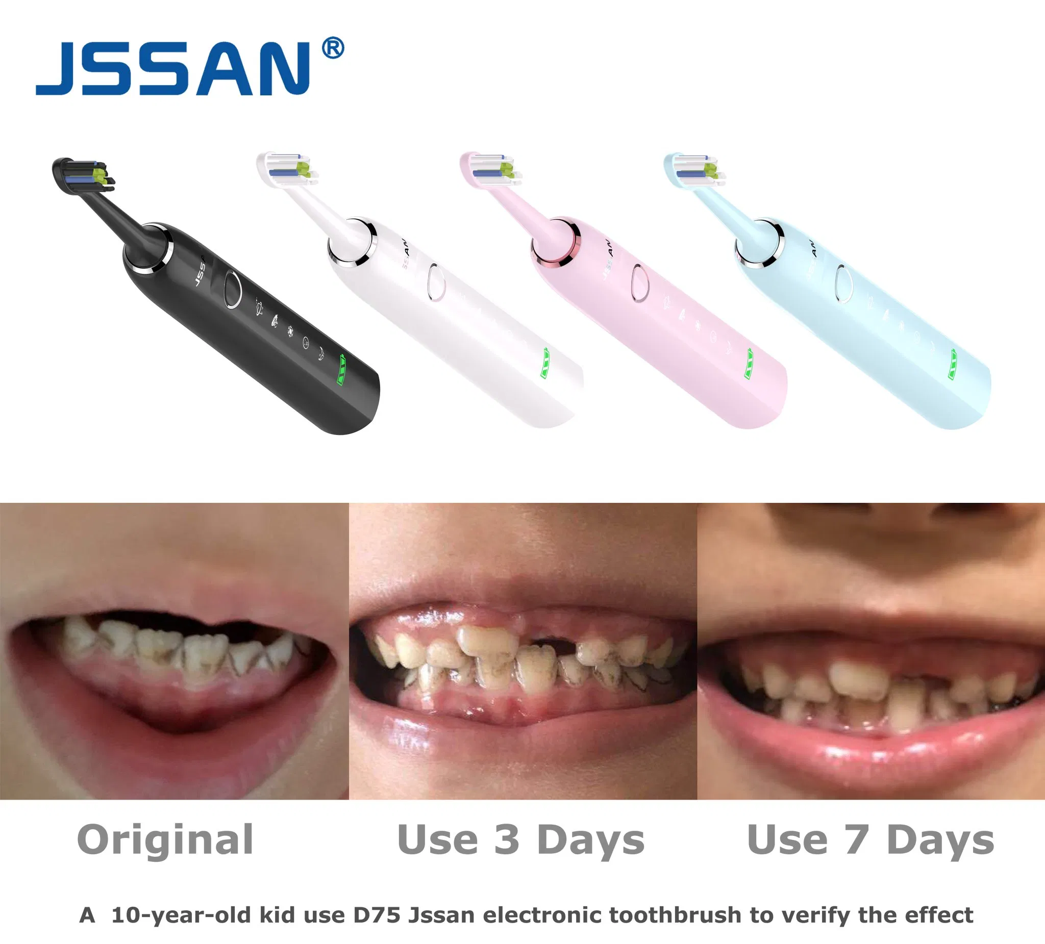 D71 Sonic Electric Toothbrush