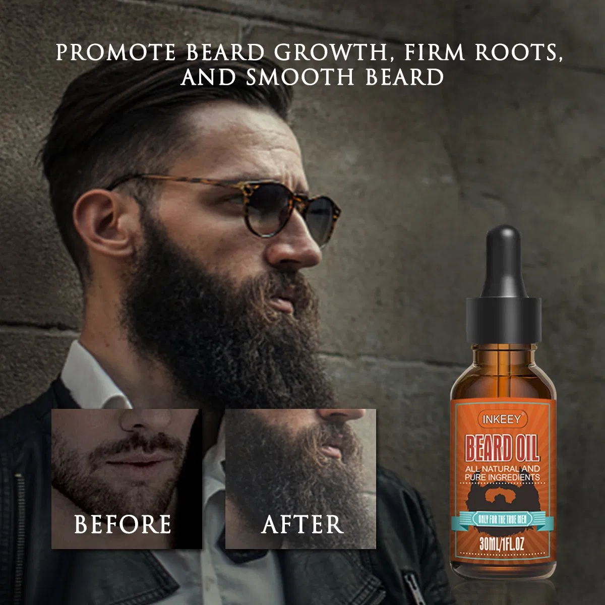 Anti Hair Loss Regrowth Custom Logo Best Hair Growth Oil for Baldness Scalp Repair Hair Oil Treatment for Beard