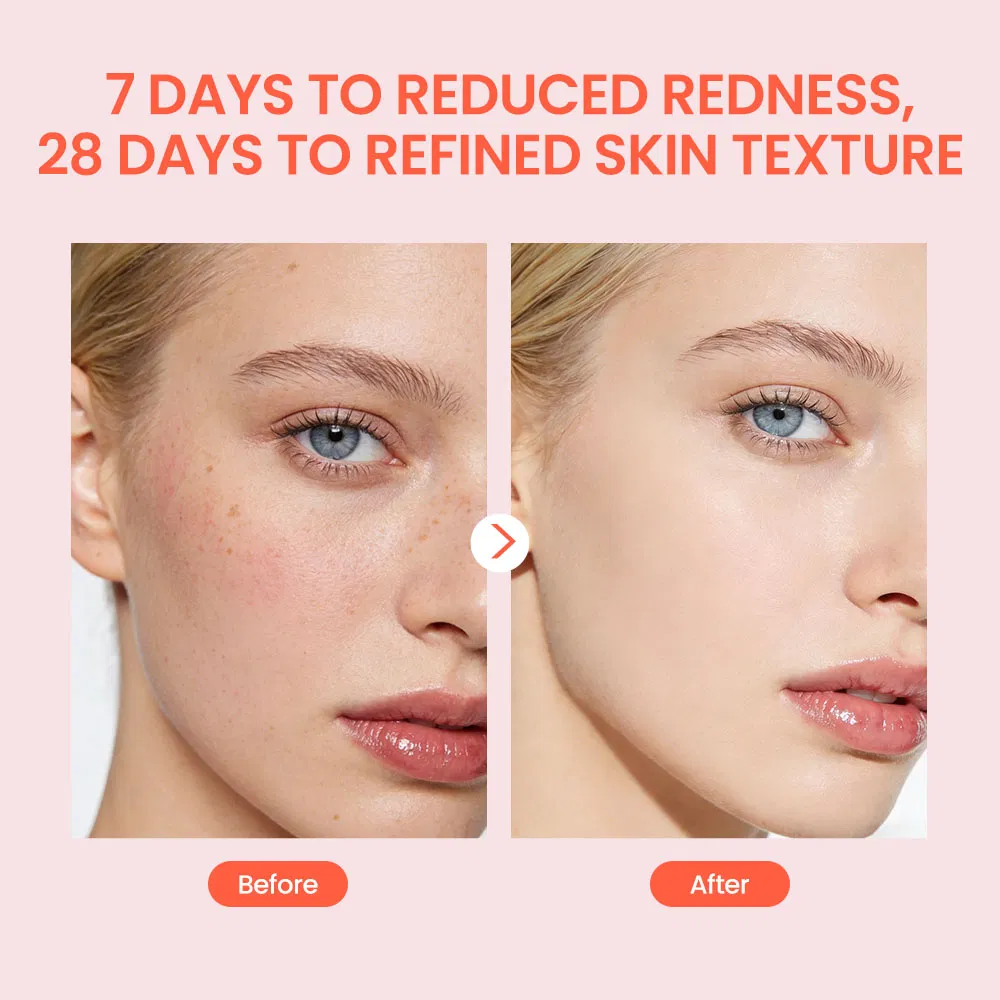 Skin Care Products Snail Mucin Hyaluronic Acid Face Care Antiaging Anti Wrinkles Serum Private Label