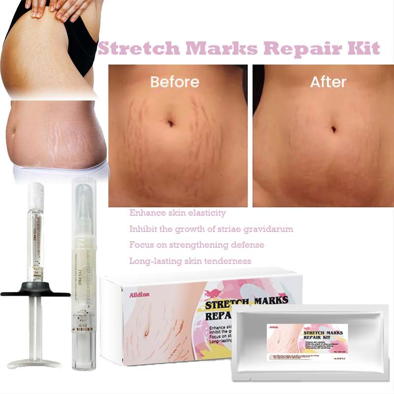 Stretch Marks Permanent Reduce Cream Eliminate Body Belly Stretch Marks Swelling Marks Reduce Skin Cracks Repair Firming Care