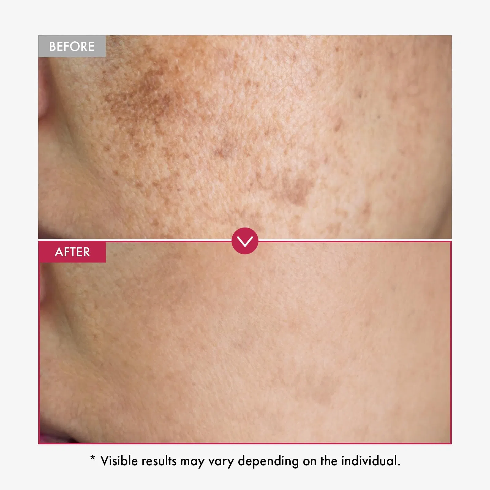 Beauty Cosmetics Skin Care Facial Anti-Aging Moisturizing and Repairing Niacinamide10% Txa4% Serum