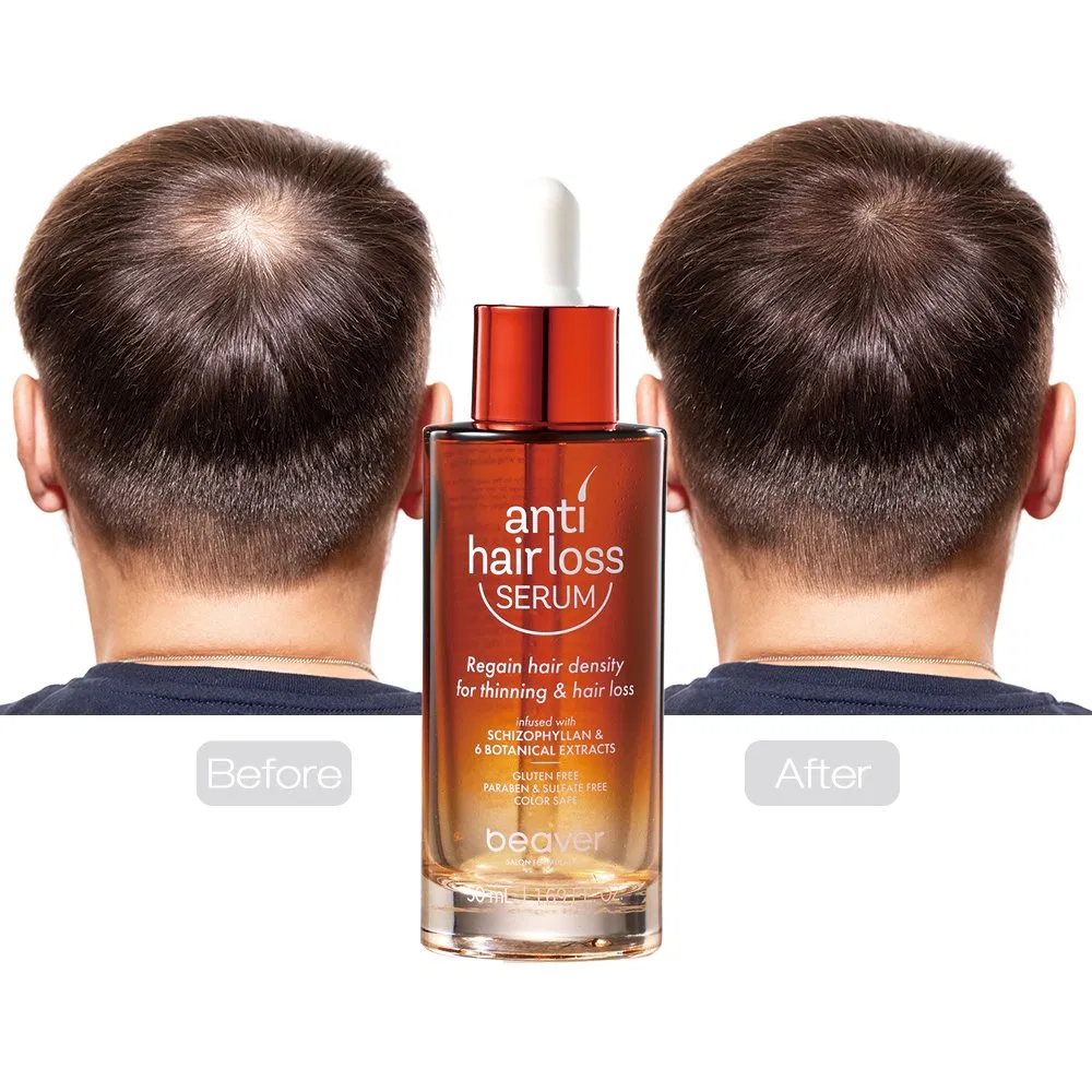 Beaver Private Label Ginger Scalp Hair Serum Oil Anti Hair Loss Serum