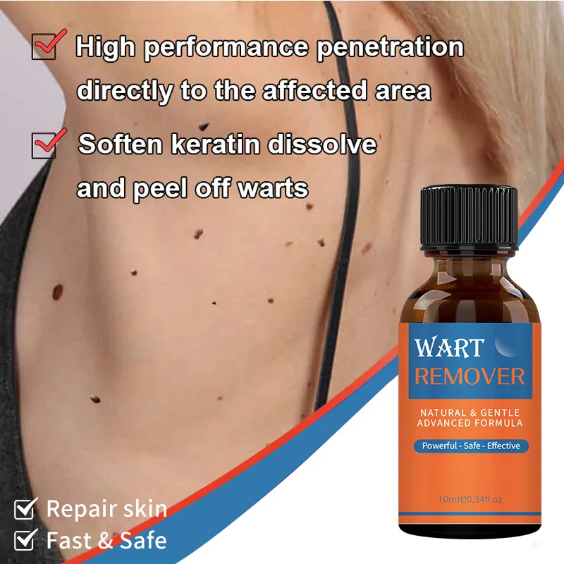 Beauty Cosmetics Skin Care Mild Powerful - Safe - Effective Wart Removing Oil