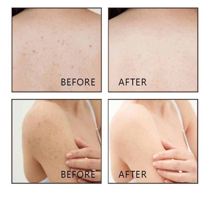 Beauty Cosmetics Skin Care Exfoliation Deep Cleansing Coffee Body Scrub