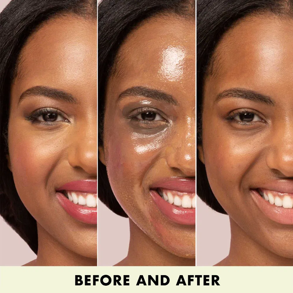 Nose Blackhead Cleanser Makeup Remover Pore Cleansing Oil for Oily Acne Skin
