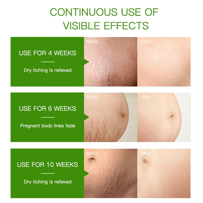 Wholesale 100% Pure Hair Face Body Massage Stretch Marks Remove Aromatherapy Dispenser Jasmine Essential Oil Fragrance
