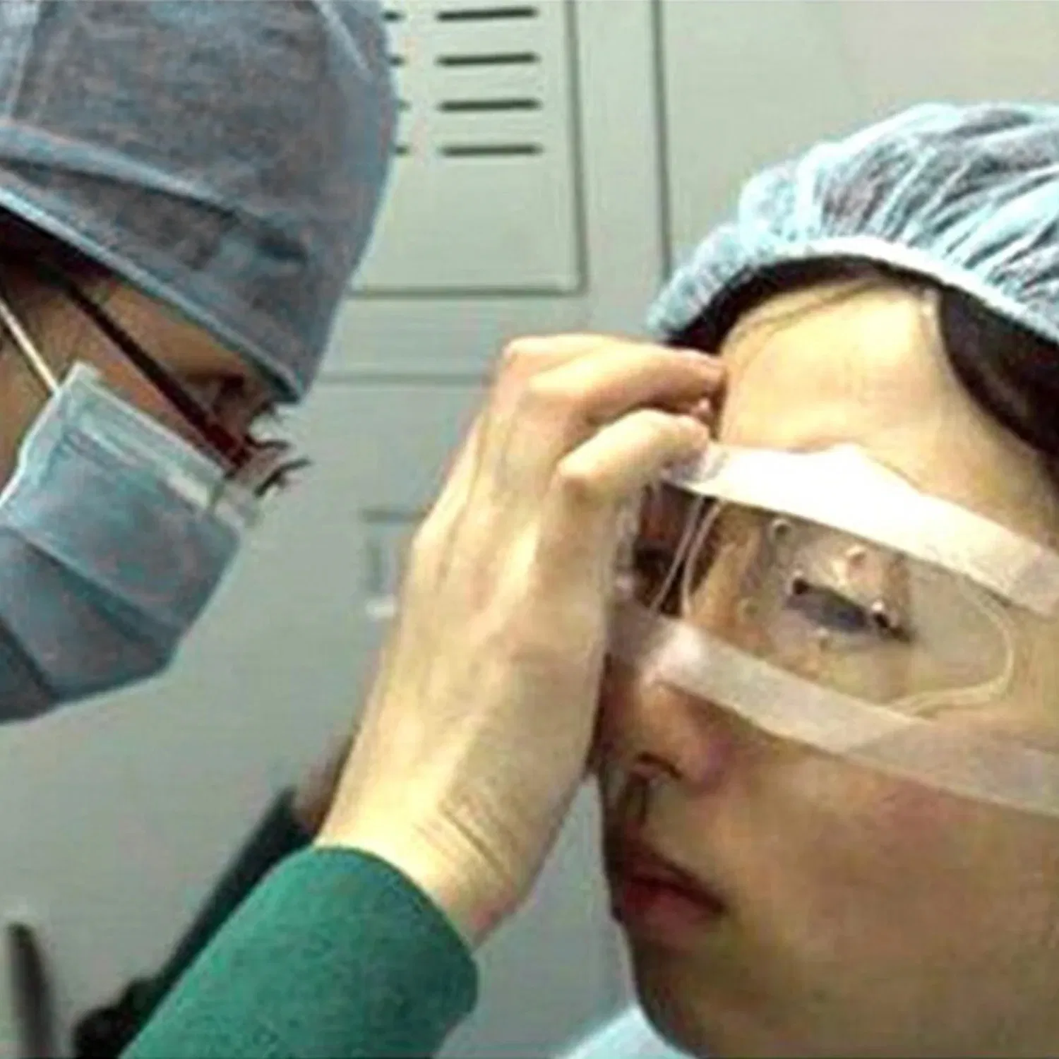 Eyecare After Surgery Transparent Ventilated Eye Shield
