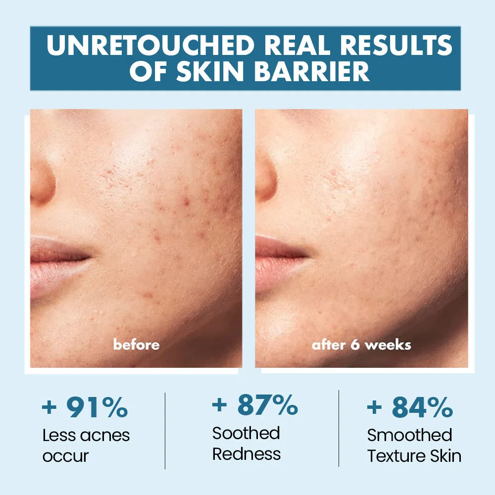 Anti-Aging Facial Moisturizer Vegan Hyaluronic Acid Face Cream Glycerin