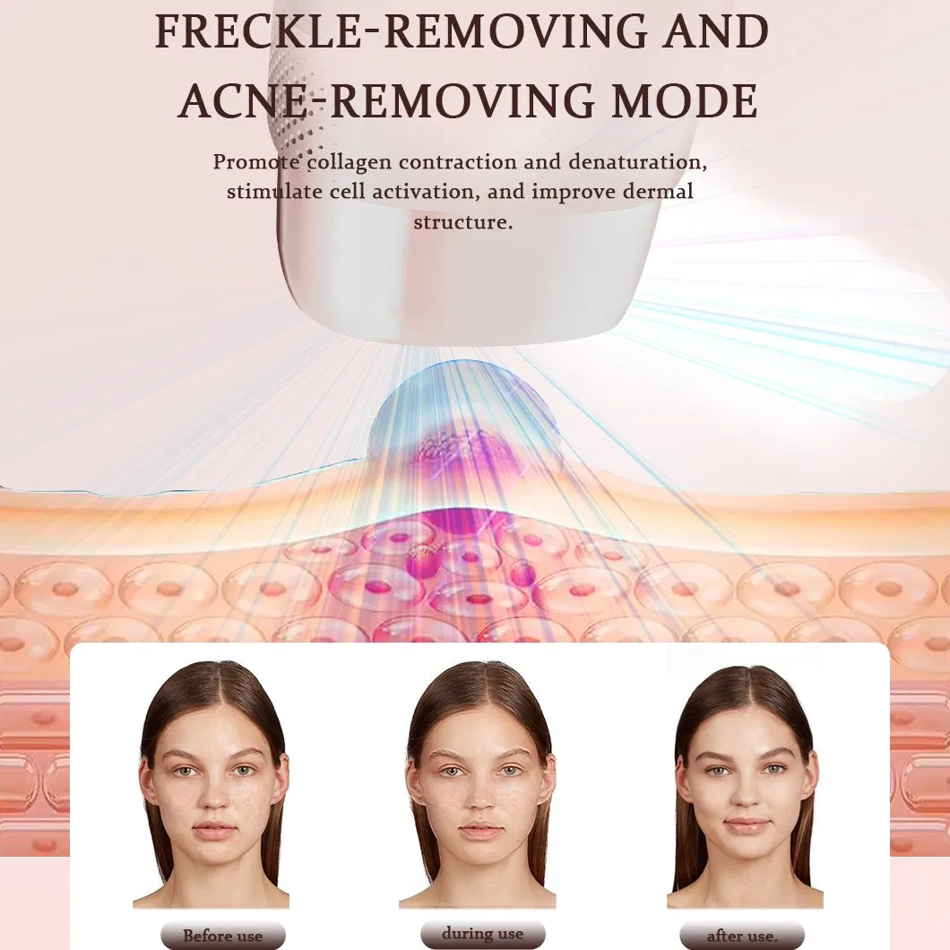 Factory Supply Multifunctional Personal Homeuse Ice IPL Laser Epilator Hair Removal Device