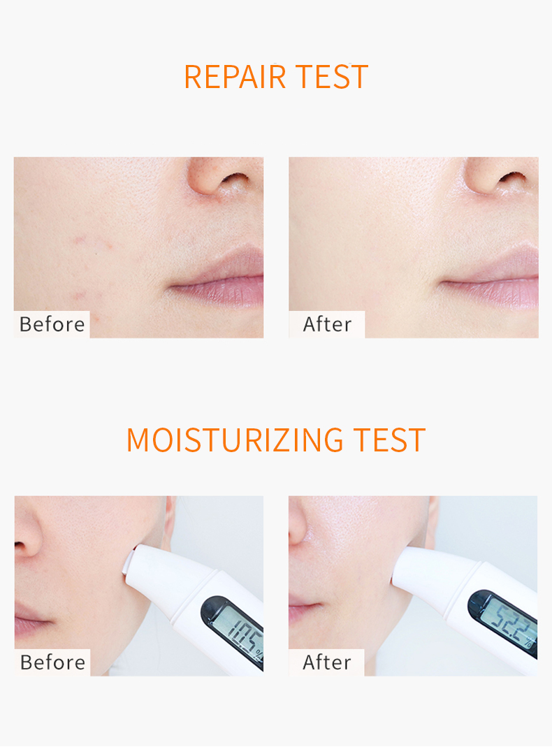 Aixin Cosmetics Skin Care Set Rose Whitening Repair Firming Korean Skincare Kit
