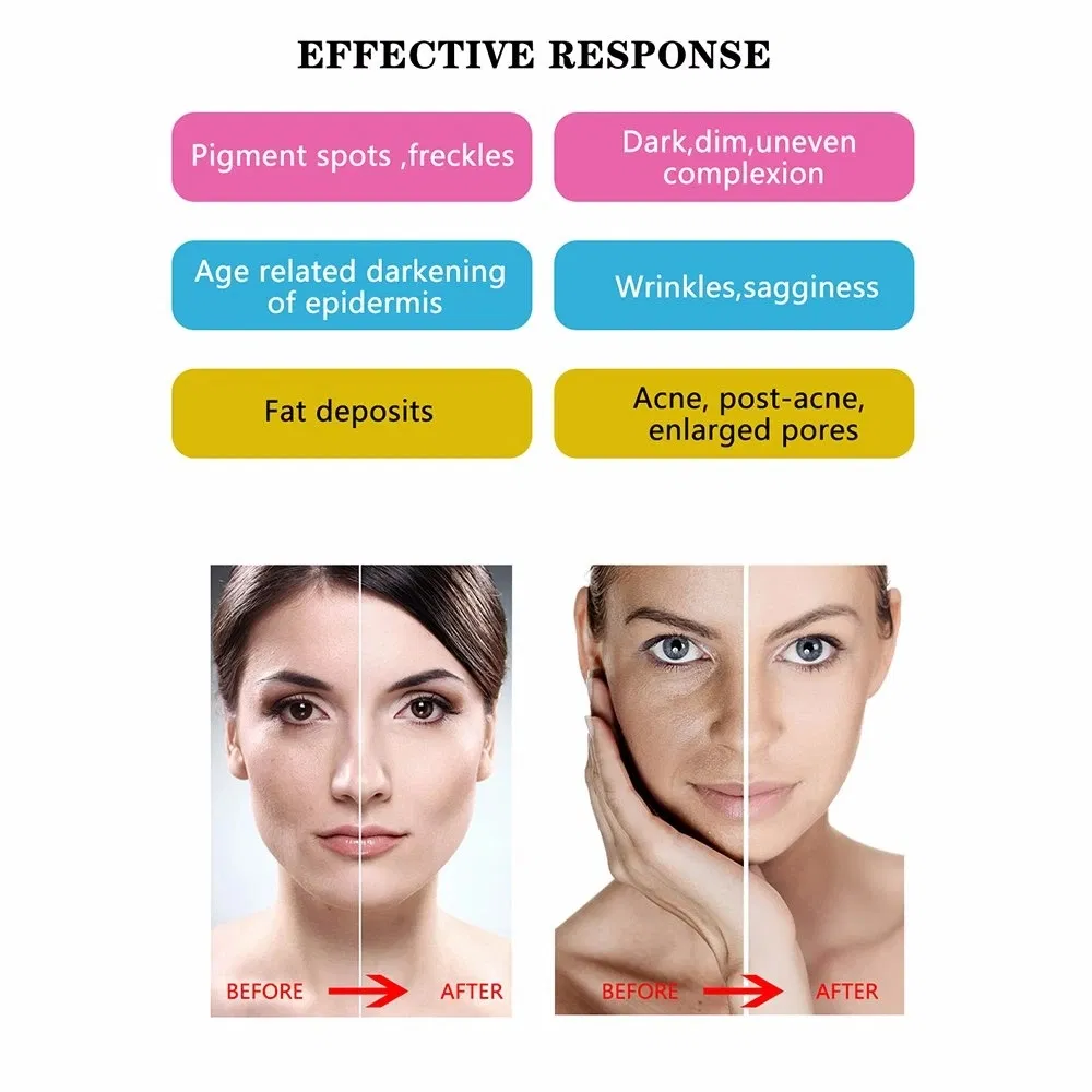 2022CE ISO FDA Wholesale Glutathione Injection Power Luthione Cindella Glutathione Skin Anti-Oxidation Vitamin C Glutax Whitening Injection Serum for Face White