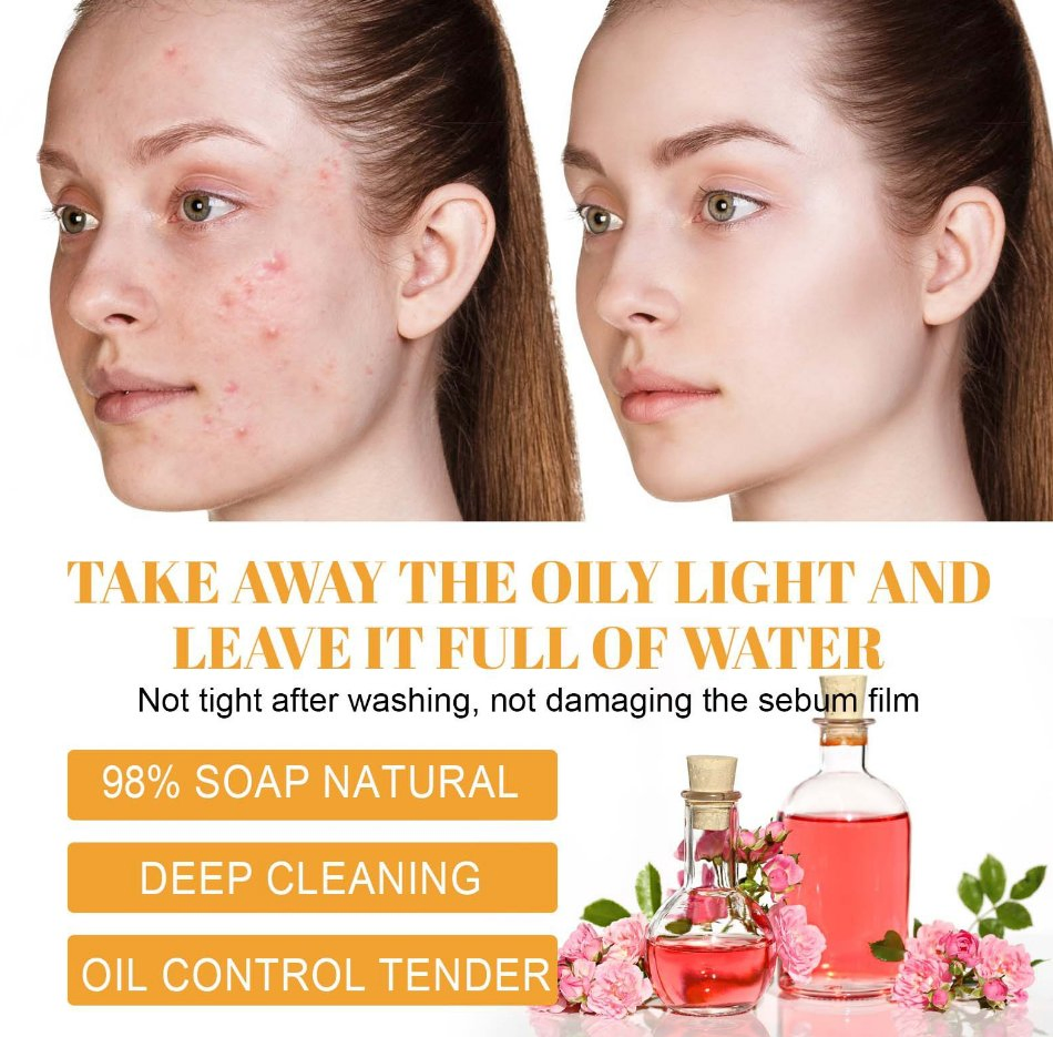 Deep Cleansing Anti Acne Brightening Kojic Acid Turmeric Cleanser Face Wash Foam 100ml Facial Cleanser Mousse Skin Care Face Wash Turmeric Foaming Cleanser