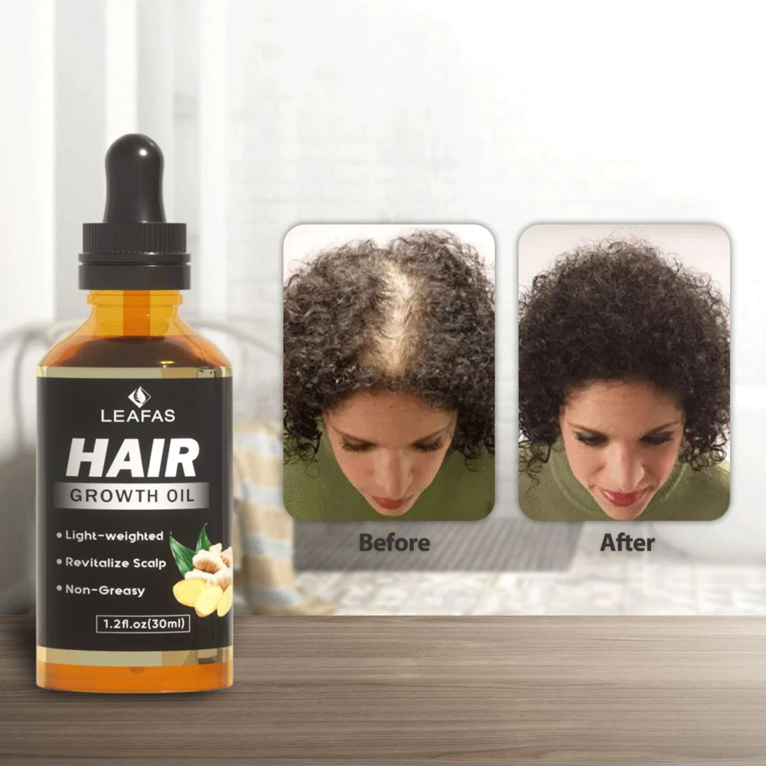 Custom Logo Natural Hair Growth Oil for Stronger Thicker Longer Hair