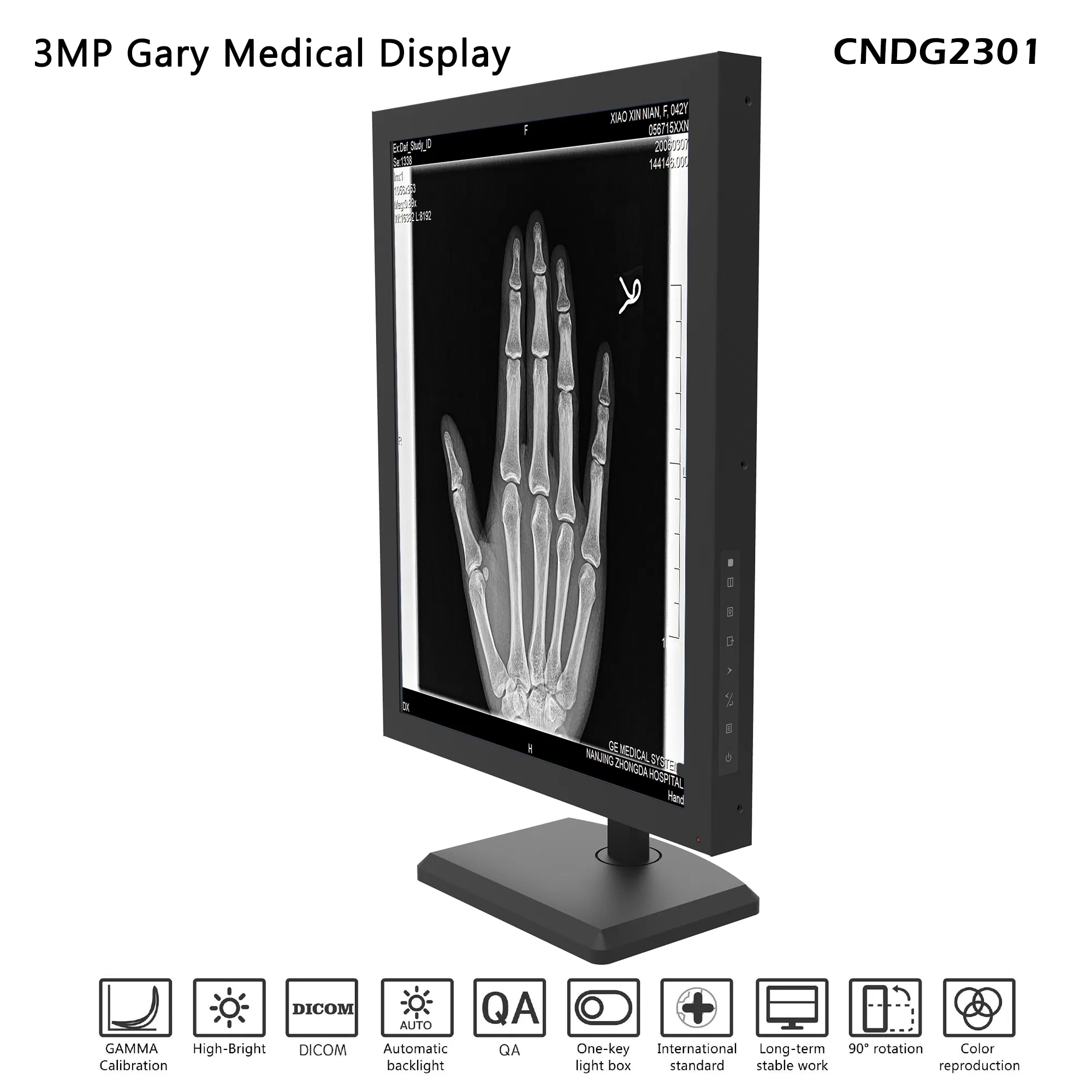 3MP 21.3 Inches Diagnostic Medical Display in Hospital Instrument