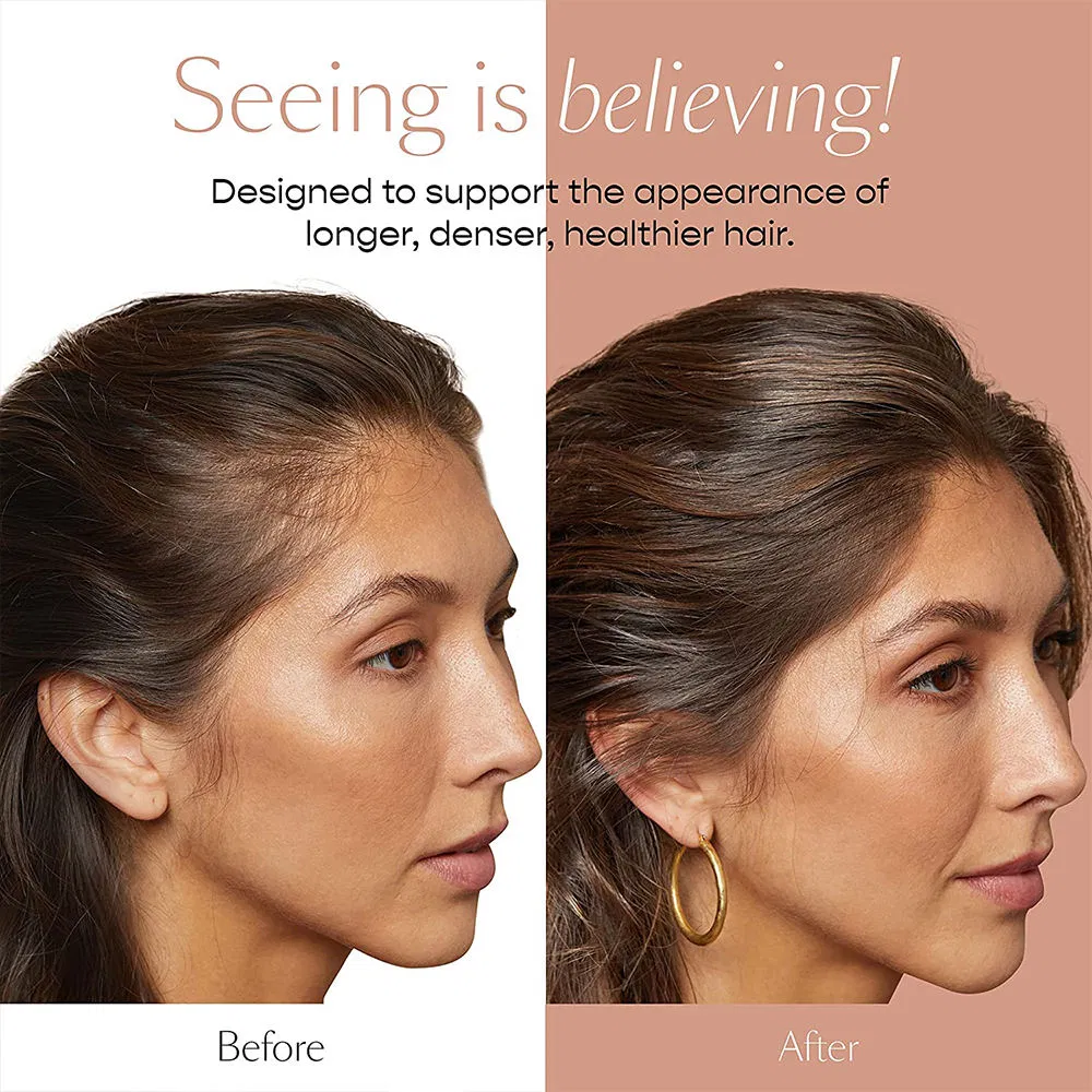 Private Label 100% Natural Organic Rosemary Castor Oil Turmeric Men Women Scalp Care Serum Hair Treatment Growth Oil