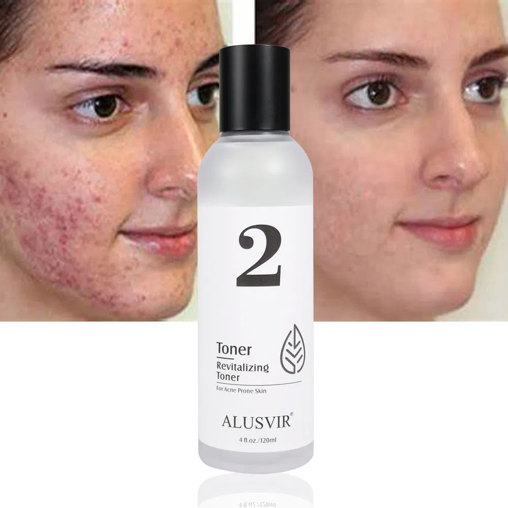 Vegan Natural Moisturizing Oil Control Facial Soothing Anti Acne Treatment Face Toner