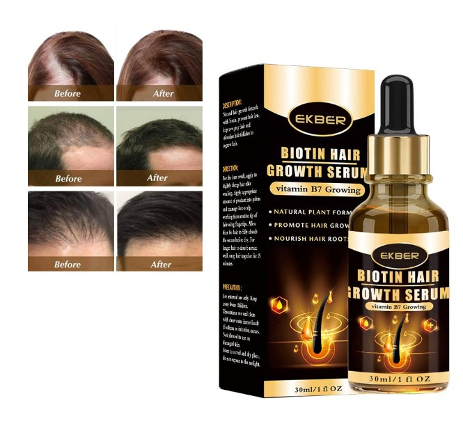 OEM ODM Wholesale Organic Anti Loss Hair Growth Serum Fuller Thicker Healthy Natural Biotin Hair Growth Serum