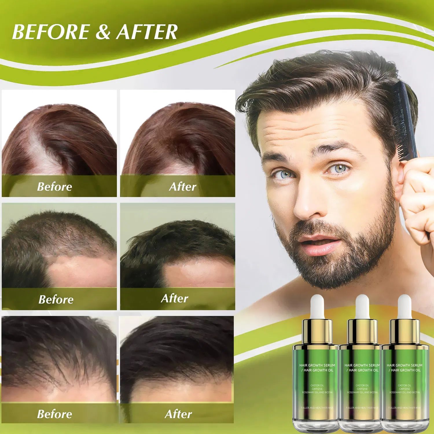 Bestselling Youth Preserving Anti-Wrinkle Cream for Prevent and Resist Early Aging