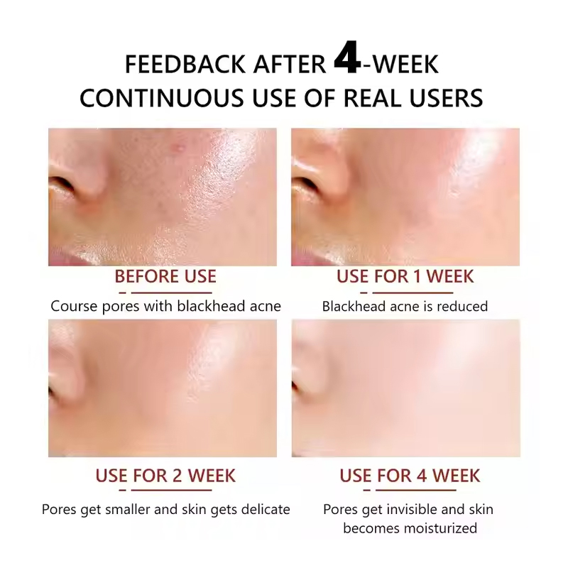 Ditong ODM Pores Treatment Skin Care Essence for Pore Shrinking and Anti Wrinkle