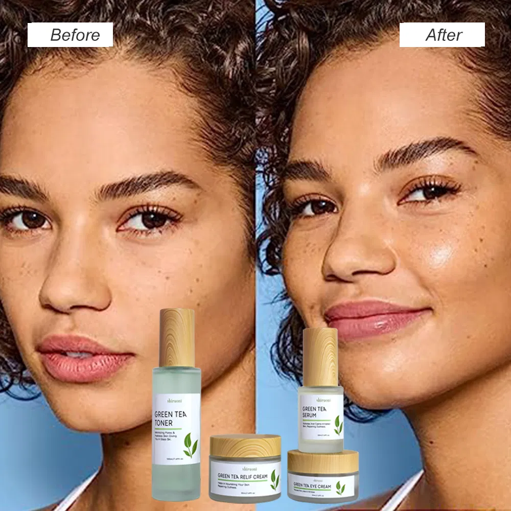 Fresh Green Tea Skin 4 Set Anti Acne and Pore Cleansing Kit Oil Control Toner/Serum/Cream