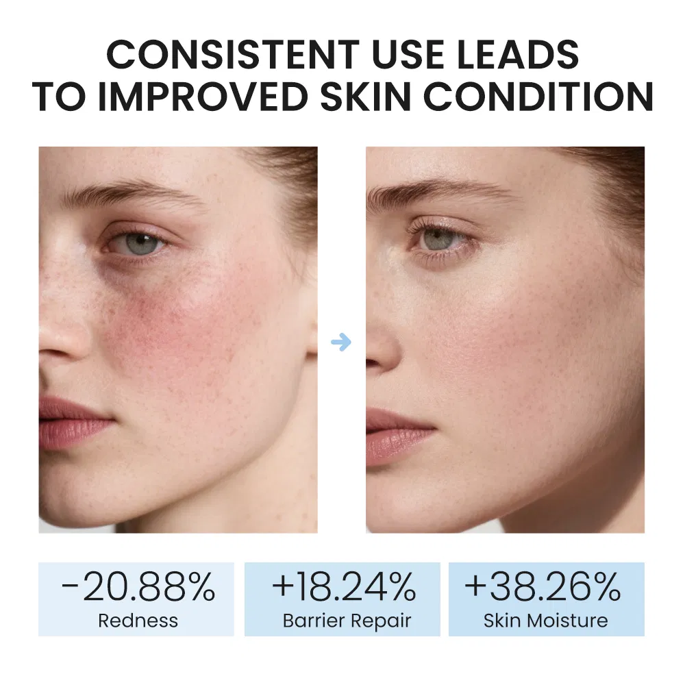 Korean Skincare Hyaluronic Acid 30ml Serum Ampoules for Radiant Face Hydration Moisture Plumping Anti-Aging Serum