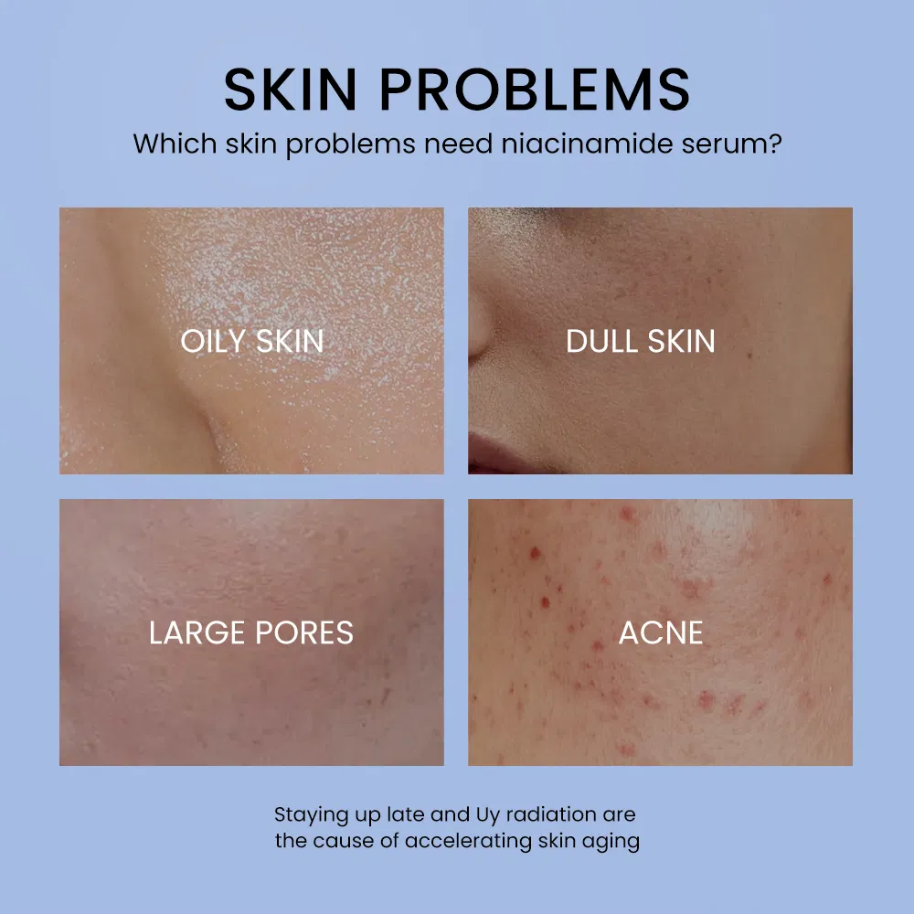 Wholesale 30ml for Retinol Skin Care Serum Essential Firming Moisturizer for All Skin Types with Ginseng Nicotinamide Face