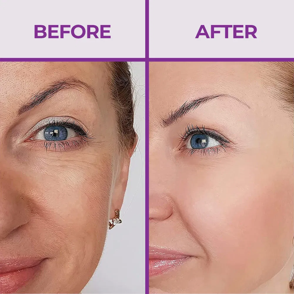 Retinol Peptide Collagen Anti-Wrinkles Friming Lifting Eye Bag Remover Eye Cream