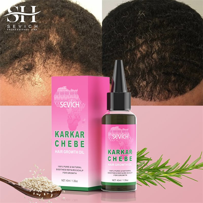 Natural Rosemary Karkar Oil Men Women Scalp Care Hair Treatment Growth Oil