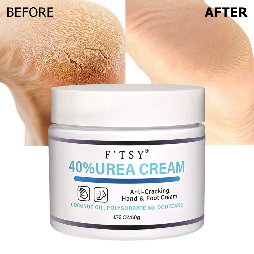 Custom Wholesale Vegan Nourishing Han Foot Urea Cream Shea Butter Anti Cracking Moisturizer
