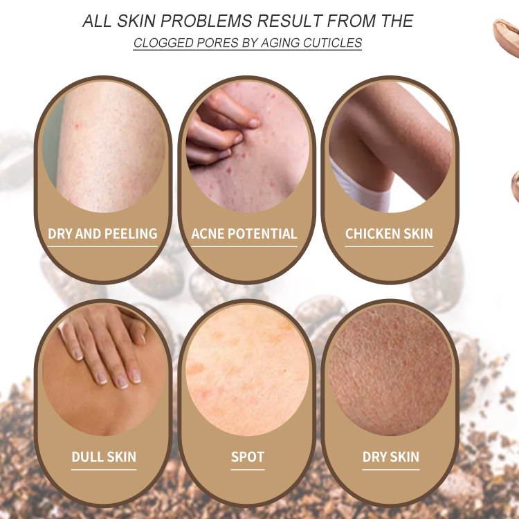 Natural Moisturizing Whitening Smooth Skin Exfoliating Pore Shrinking Coconut Bodywash Shower Gel