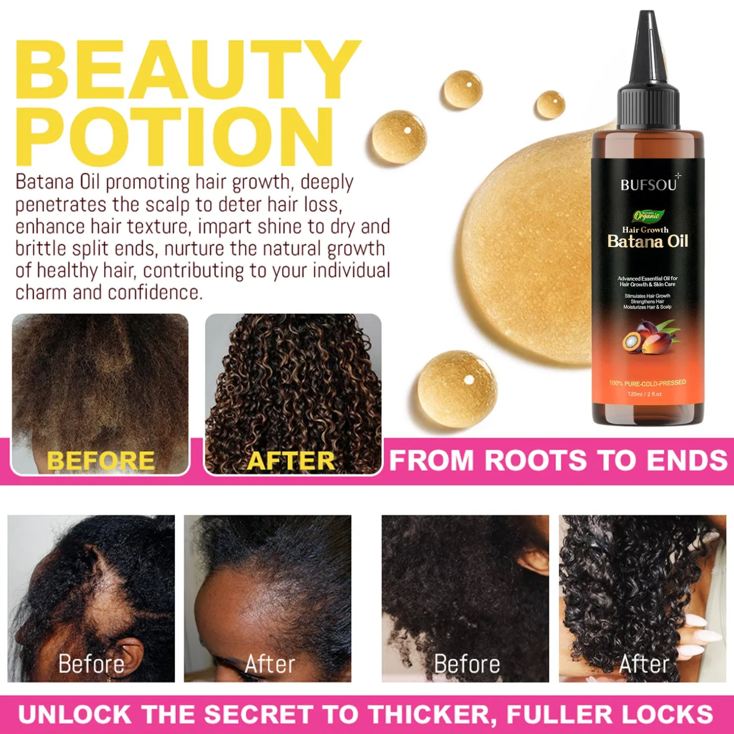 Hotsale in Africa Anti Hair Loss Natural Treatment Private Label Nourishing Organic Hair Growth Batana Hair Oil