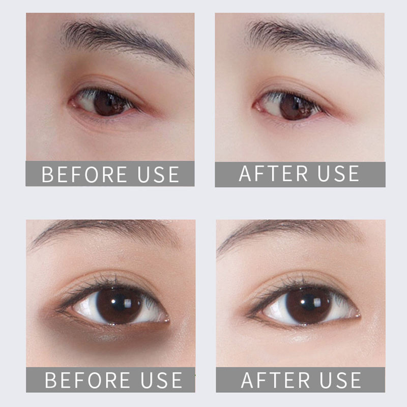Aixin Beauty Cosmetics Eye Care Dark Circles Skin Care Products Eye Gel Pads