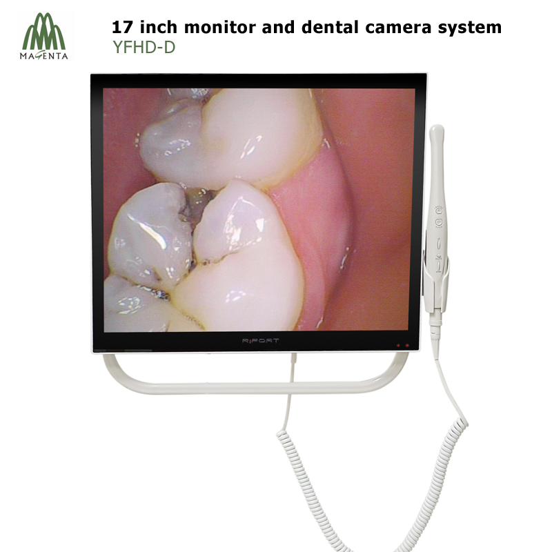 17 Inch LCD Screen and Dental Camera to Dental Unit Intraoral Camera Unit