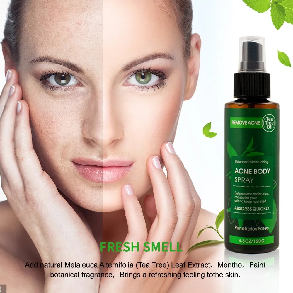 Private Label Tea Tree Oil Extract Treatment Spray Facial Mist Anti-Acne Remover Glowing Whitening Hydrating Face Body Spray