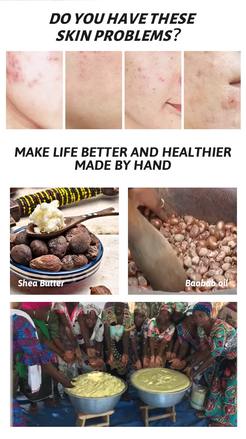 African Black Soap with Palm Kernel Coconut Olive Oils Aloe Vera Snowparsley for Dark Spot Removal Includes Deep Cleaning