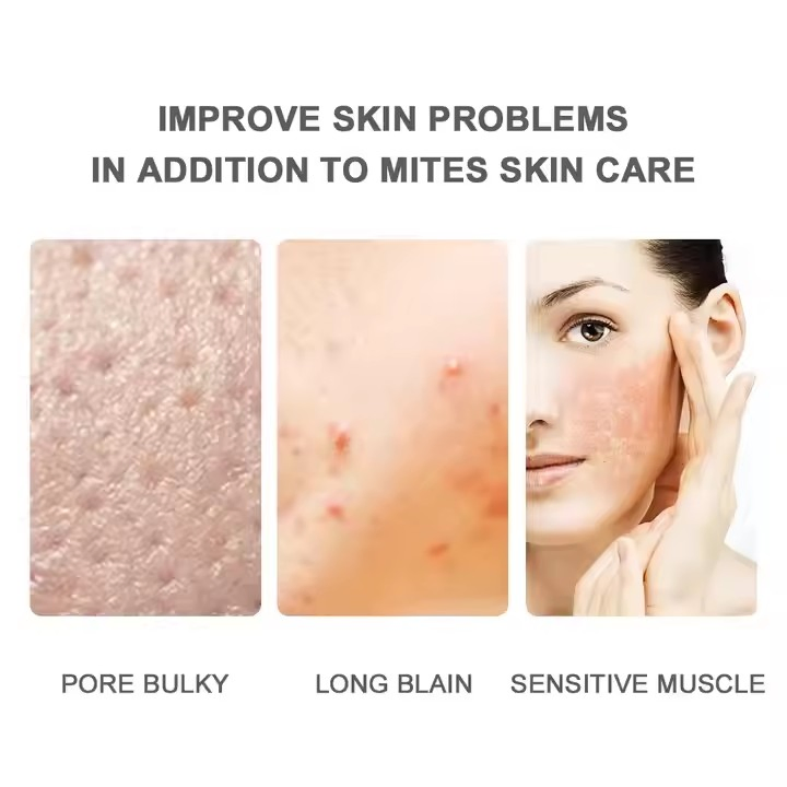 Hot Selling Herbal Skin Care 100% Natural Deep Cleansing Toilet Soap for Face and Body