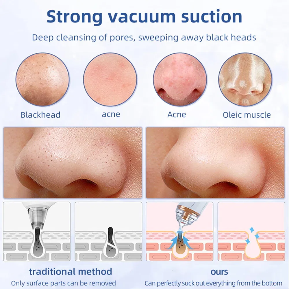 Deep Cleaning Pore Vacuum Tool for Flawless Skin