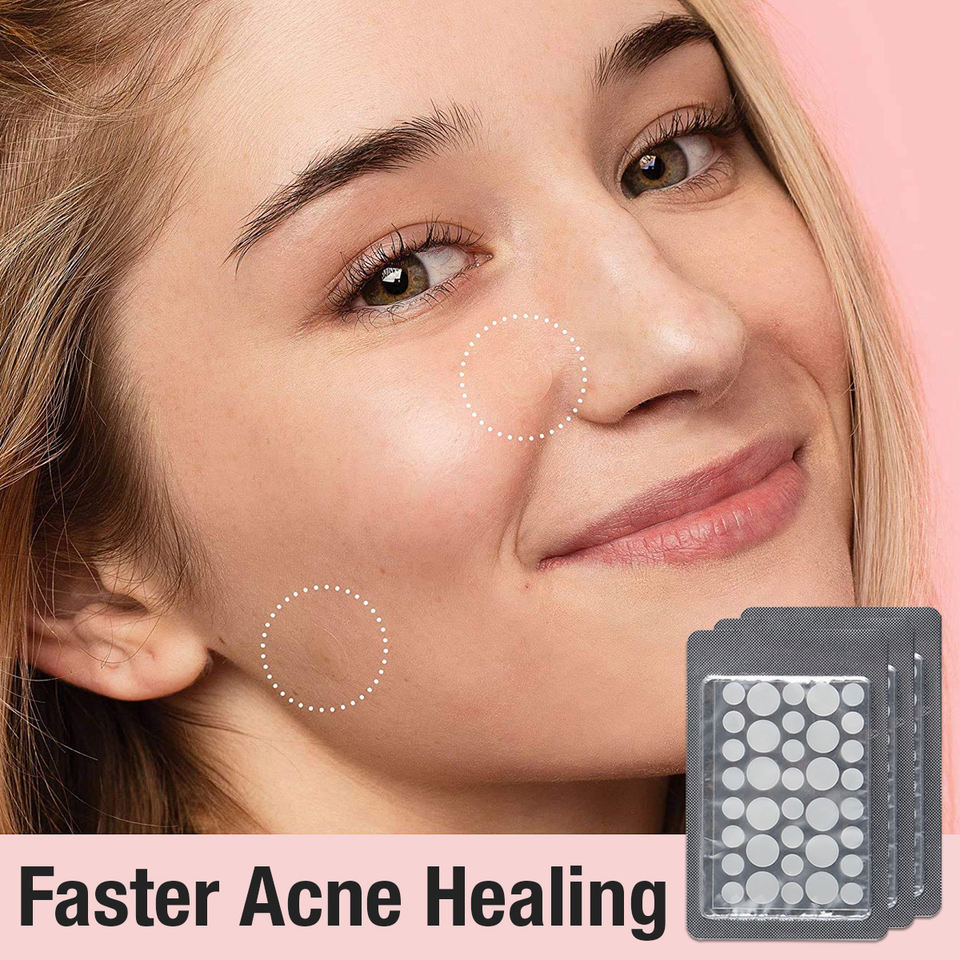 Гидроколлоидные пластыри от прыщей, невидимые, 8-12 мм