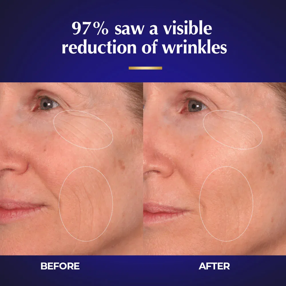 Exosome Face Toner Anti-Aging Moisturizer Liposomes Mitochondria Whitening