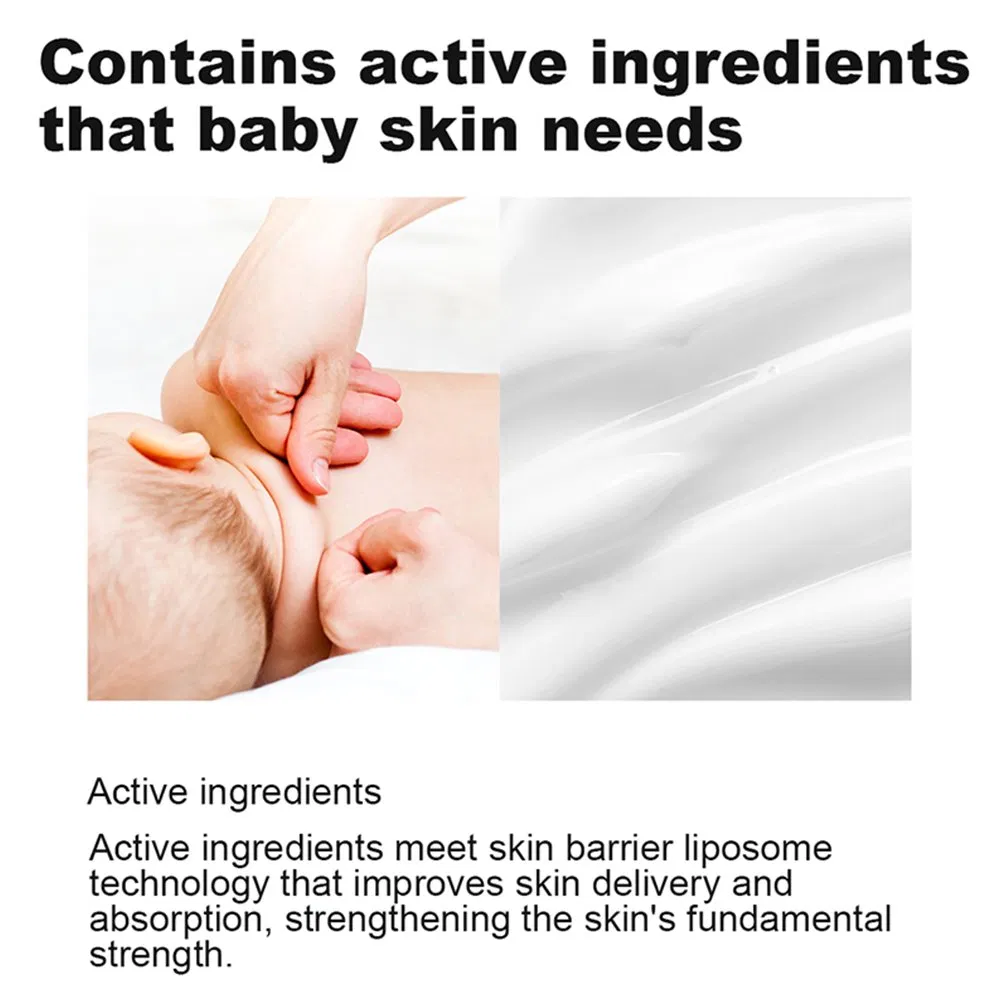 Baby Diaper Rash Cream Natural Gentle Formula Soothes Calming Irritated Baby Skin