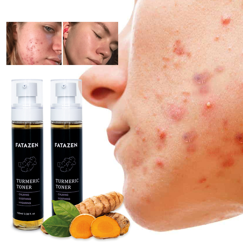 Organic Vitamin C Moisturizing Skin Care Deep Hydrating Repair Turmeric Face Toner