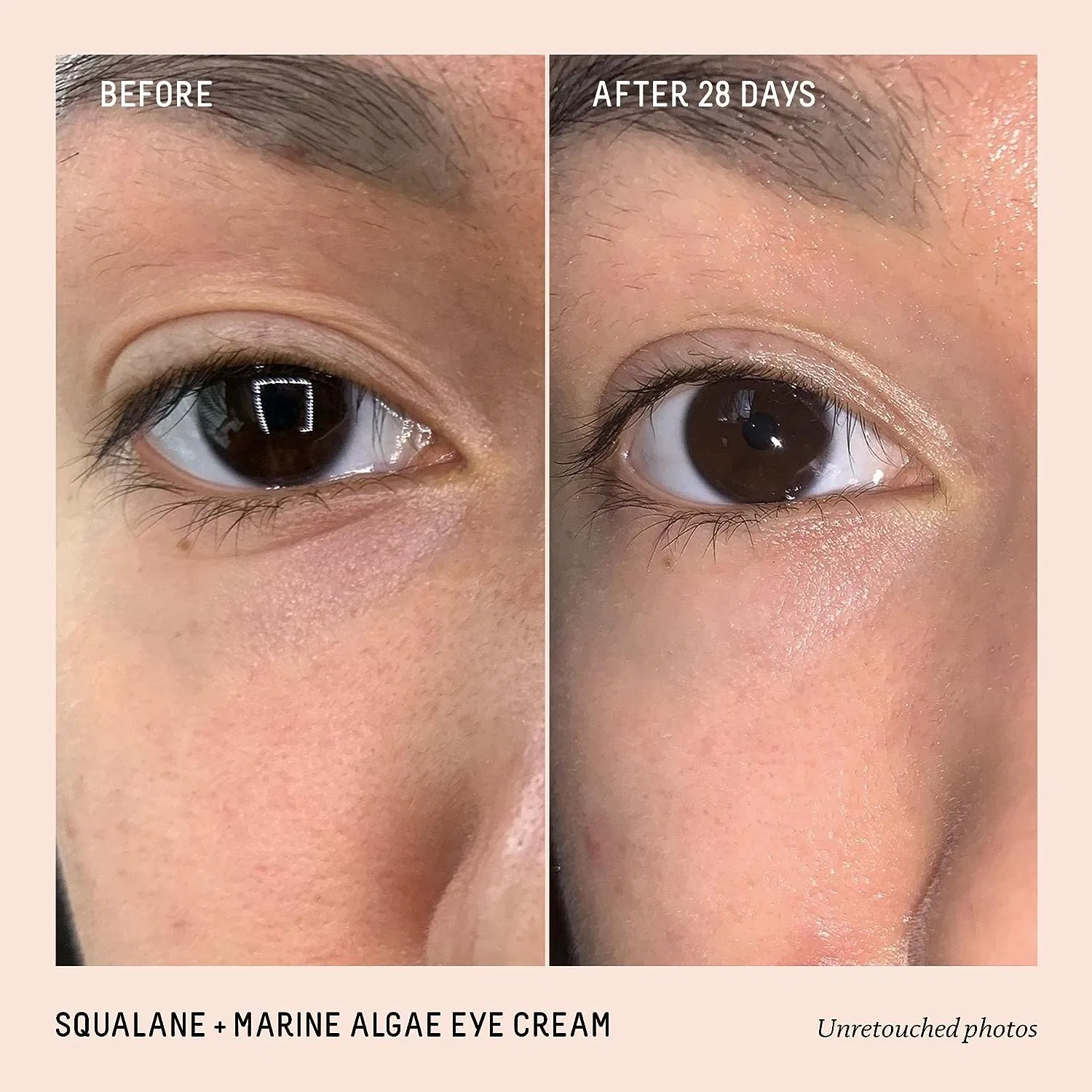 OEM/ODM Custom Squalane + Marine Anti-Aging Lifting Smoothing Eye Cream
