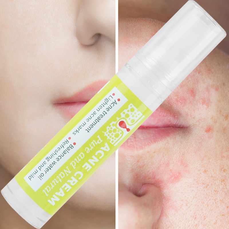 Natural Organic Oil Control Shrinks Pores Woman Skincare Deep Cleansing Acne Cream