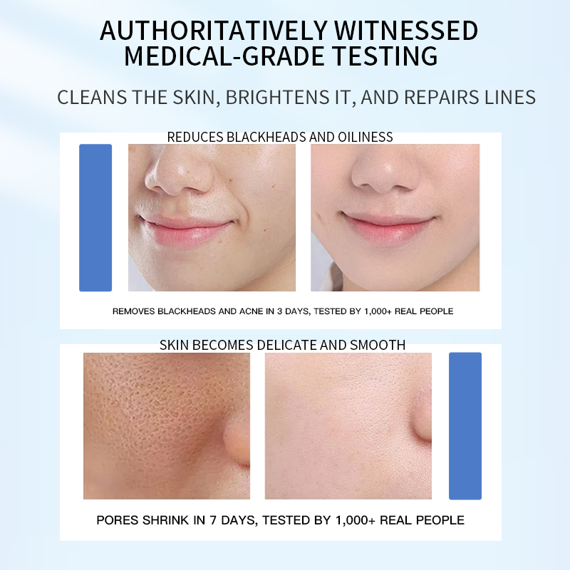 Asian Soothing for Sensitive Skin Travel Must-Have Calming Reparing Essence Toner